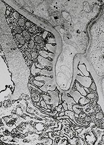 hyphal intrusion